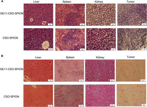 Figure 8. Microscopic observation of the image of tissue section after injection of CSO-SPION and GE11-CSO-SPION. (A) H&E staining; (B) Prussian blue staining. 200X magnification; 50 μm scale.