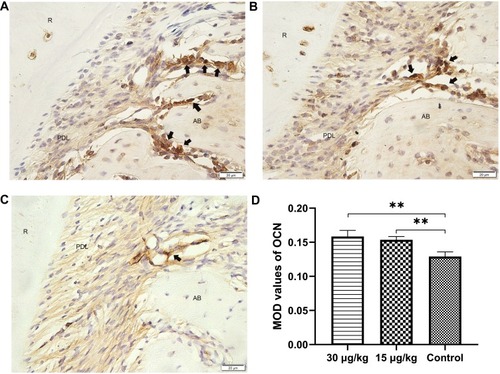 Figure 12 Expression of OCN in the tension side of distopalatal root of maxillary molar.