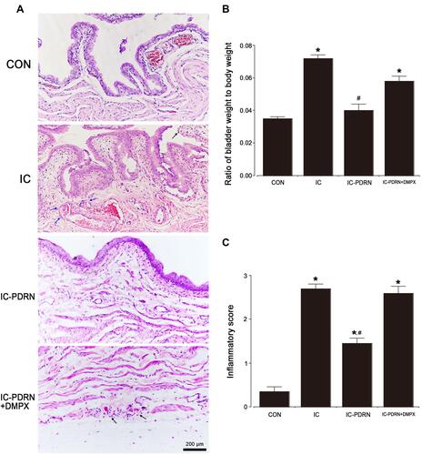 Figure 3 Ratio of bladder weight to body weight and inflammatory score. (A) Histological changes in the bladder tissue. (B) Ratio of bladder weight to body weight in each group. (C) Inflammatory score in each group. Black arrows indicate epithelial detachment, erosion, and inflammatory cells. Blue arrows indicate edematous stroma and irregularly ectasia vessels. *Indicates P < 0.05 when compared with the control group. #Indicates P < 0.05 compared with the IC-induced group.