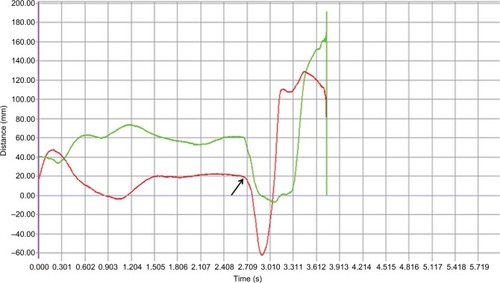 Figure 1 The onset determination of gait initiation.