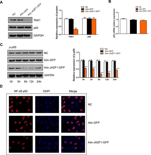 Figure 5 Overexpression of JAZF1 inhibits TAK1 and NF-κB p-p65 expression and inhibits NF-κB p65 nuclear translocation in BCPAP cells. (A) WB analysis of the protein levels of TAK1 and NF-κB p65 in response to JAZF1 overexpression. ***P<0.001. (B) RT-qPCR analysis of the mRNA levels of NF-κB p65. (C) Protein levels of NF-κB p-p65 at different times in response to JAZF1 overexpression. ***P<0.001. (D) Detection of NF-κB p65 subcellular localization, red indicates NF-κB p65 and blue indicates nuclei.