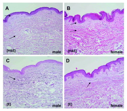 Figure 1. A comparison between male (A and C) and female (B and D) endogenous aged skin. Staining via hematoxylin eosin (A and B) and elastica staining (C and D), respectively, revealed that the dermis in the male is significantly thicker than in the female. In contrast, epidermis and subcutaneous tissue are significantly thicker in the female.