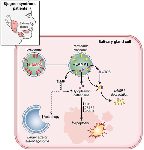 Figure 8. LAMP3 inhibited autophagy and induced apoptosis via lysosomal membrane permeabilization. LAMP3 OE in minor salivary gland of SS patient leads to lysosomal membrane permeabilization via decreasing LAMP1 protein integrity and its degradation by CTSB, resulting in inhibited autophagy, and cathepsins relocalization. Relocalized cathepsins (CTSB and CTSD) induces the increase in cell death by caspase-dependent apoptosis.