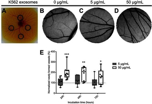 Figure 2 Image of the chicken embryo aspect (A) and of the interior of each O-ring placed on the chorioallantoic membrane (CAM). Images were acquired after 24 hrs incubation with 0 µg/mL (B), 5 µg/mL (C) or, 50 µg/mL (D) of K562 derived exosomes. Whiskers plots of the percentage of newly formed vessels after exposure to 5 µg/mL (gray bars) or 50 µg/mL (black and white bars) of K562 exosomes (E). Bars represent the maximum, minimal, and mean of at least seven independent experiments, represented as dots (5 µg/mL) and squares (50 µg/mL), normalized to the number of tertiary veins obtained after exposure to phosphate buffer saline (PBS) and to the normalized number obtained in the corresponding CAM area at 0 hrs incubation in the same embryo. Dotted line at 100% normalized newly formed vessels refers to the control sample – number of tertiary veins obtained after exposure to PBS and to the normalized number obtained in the corresponding CAM area at 0 hrs incubation. ***p-value 0.0003, **p-value 0.0056, *p-value 0.13 comparing to the CAM regions exposed to PBS. p-value was calculated using an unpaired t-test with Welch’s correction.Abbreviation: PBS, phosphate buffer saline.