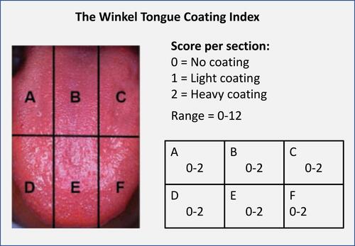 Figure 2 Winkel Tongue Coating Index.Citation48,Citation49 The dorsum of the tongue is divided into sections and the amount of tongue coating is graded subjectively (0–2) for each section. The total score, ranging from 0 to 12, is calculated by adding the scores for each individual section.