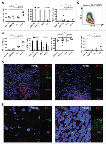 Figure 2. PD-1 as well as PD-L1 positive T cells were analyzed by flow cytometry and are increased in the tumor microenvironment of gastric adenocarcinoma. (A) Scatter plots and bar graphs showing results of flow cytometric analyses of PD-L1 expression on T and B cells in gastric adenocarcinoma samples (n = 10), TDLN (n = 11), PBMC HC (n = 10) and PBMC AC (n = 14). (B) Scatter plots and bar graphs showing expression of PD-1 on T cells and T-cell subsets in PBMC HC (n = 10), PBMC AC (n = 14), TDLN (n = 10) and gastric adenocarcinoma samples (n = 10) as assessed by flow cytometry. PD-1+ T cells mainly show an effector-memory phenotype with a CD45RA−/CCR7− signature (right plot). (C) Exemplary density plot showing expression of PD-1 and PD-L1 on T cells (gated on CD45+CD3+ lymphocytes). Scatter plot showing the percentage of T cells coexpressing PD-L1 and PD-1 in tumor samples (n = 11), PBMC HC (n = 10), PBMC AC (n = 10) and TDLN (n = 10). (D) The spatial distribution of tumor-infiltrating T and B cells expressing PD-L1 was analyzed by four-color immune-fluorescence microscopy. In the left image, tumor cells as well as a fraction of tumor infiltrating CD3+ (green) T cells express PD-L1 (red), whereas B cells (CD20+, magenta) in the tumor microenvironment are mainly PD-L1 negative (right image). (E) Confocal microscopy of T cells in the tumor microenvironment. The distribution of PD-1+ (magenta) T cells was similar to PD-L1+ (red) T cells. Two representative images with either expression of PD-1 alone (left image) or coexpression of PD-1 and PD-L1 (right image) are shown.