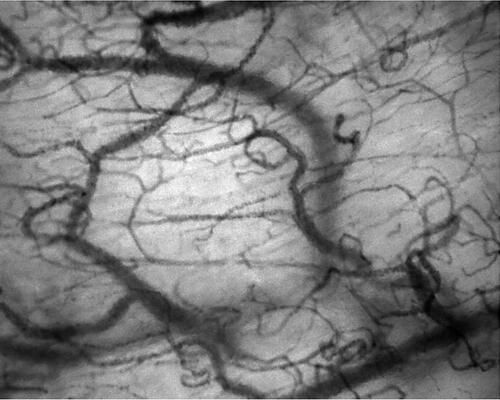 Figure 1 High-quality image of the sublingual microcirculation obtained by means of incident dark field (IDF) videomicroscopy, with good contrast, adequate focus, and even illumination.