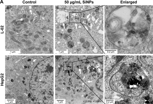 Figure 3 SiNPs induced autophagosome accumulation in L-02 and HepG2 cells.Notes: (A) TEM images showed autophagosome accumulation in L-02 (a, b, c) and HepG2 cells (d, e, f) with SiNP treatment. a,d: untreated control cells; b,e: cells treated with 50 μg/mL SiNP for 24 h; c,f: the enlarged autophagosome or autolysosome. Black arrow, double-membrane autophagosome; white arrow, single-membrane autolysosome. Magnification: a, 8,000×; b, 6,000×; c, 30,000×; d, 12,000×; e, 12,000×; f, 60,000×. (B) After treatment with different doses of SiNPs (12.5, 25, and 50 μg/mL) for 24 h, the cells were fixed and analyzed by indirect immunofluorescence using anti-LC3B. Distribution patterns of cytoplasmic LC3B in control and SiNP-treated cells were visualized with LSCM, and the selected areas were magnified. LC3B (green) and DAPI staining of nuclei (blue) is shown. Quantification represents the number of punctate LC3B per cell in untreated control and SiNP-treated cells. Data are expressed as mean ± SD. *P<0.05 compared with control.Abbreviations: DAPI, 4′,6-diamidino-2-phenylindole; LSCM, laser scanning confocal microscope; N, nucleus; SD, standard deviation; SiNPs, silica nanoparticles; TEM, transmission electron microscopy.