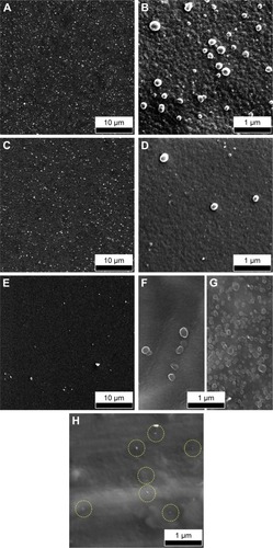 Figure 10 SEM images of BG-O (A, B), BG-3S (C, D), and BG-5S (E, F) coatings tested in vitro for 28 days in DC.Notes: Panoramic (A, C, E) and detailed (B, D, F) views. (G) Comparative SEM image of a BG sample immersed for 7 days in SBF medium. (H) SEM images of BG-O tested in vitro for 28 days in DCC.Abbreviations: SEM, scanning electron microscopy; BG-O, films deposited from the simple BG target; BG-3S, films deposited from BG target with three silica plates; BG-5S, films deposited from BG target with five silica plates; DC, DMEM supplemented with 10% FBS; DCC, DC in homeostatic atmosphere; DMEM, Dulbecco’s Modified Eagle’s Medium; FBS, fetal bovine serum; SBF, simulated body fluid.