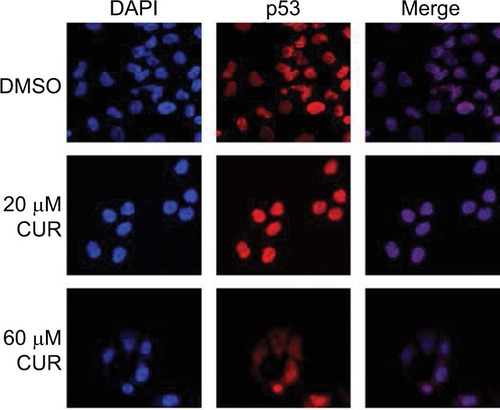 Figure 4 Effects of CUR on the immunolocalization of p53 in T-47D cells.