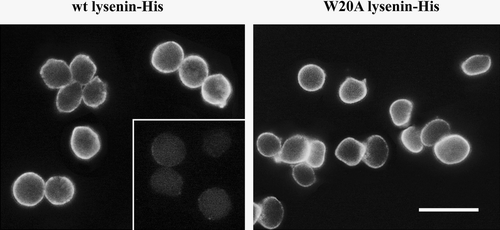 Figure 2.  Binding of wt and W20A lysenin to the surface of sheep erythrocytes. Cells were fixed with 1% glutaraldehyde and exposed to the proteins in the presence of 5 mM imidazole, followed by rabbit anti-His IgG and anti-rabbit IgG-FITC. Inset shows cells treated with bacterial sphingomyelinase (70 mU/ml, 1 h, 37°C) before fixation and staining with lysenin. Bar, 10 µm.