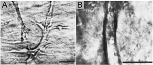 Figure 2 (A and B) Phase contrast photomicrographs of 3D cultures of either (A) mIMCD cells or (B) ureteric bud (UB) cells grown for 48 hr. The cells were grown in the presence of either 3t3 cell conditioned medium (A—source of HGF) or BSN cell conditioned medium supplemented with 0.5% FBS (Bar = 25 µm). (From ref. Citation39).