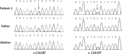 Figure 2. Results of sequencing for the c.1418C > T and c.2419C > T mutations in ATP6V0A4 in family-1.