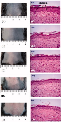 Figure 7. Photographs of mouse skin (A–E) and histology images (F–J) in groups C1, C2, U, UB and UBD at week 4 of treatment. C1 = no treatment group, C2 = penetrating α-arbutin alone group, U = 2-W/cm2 US combined with penetrating α-arbutin group, UB = 2-W/cm2 US combined with MBs and penetrating α-arbutin, and UBD = 2-W/cm2 US combined with 10-fold-diluted MBs and penetrating α-arbutin.