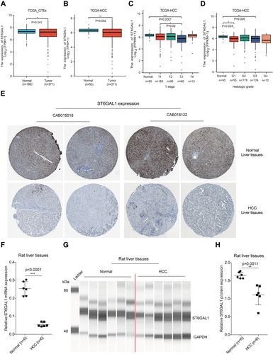 Figure 1 ST6GAL1 expression in normal and HCC liver tissues. (A) The ST6GAL1 mRNA expression of HCC (n = 371) and normal tissues (n = 160) in the TCGA and GTEx databases; (B) The ST6GAL1 mRNA expression of HCC (n = 371) and adjacent non-tumor tissues (n = 50) in the TCGA database; (C and D) The ST6GAL1 mRNA expression of different T stages (C) or histologic grades (D) in the TCGA database; (E) The ST6GAL1 protein expression in the HPA database; (F) The ST6GAL1 mRNA expression levels in liver tissues of normal (n = 6) and HCC (n = 6) rats, detected by qRT-PCR and GAPDH as the internal reference; (G) The ST6GAL1 protein expression levels in liver tissues of normal (n = 6) and HCC (n = 6) rats, detected by capillary electrophoresis analysis and GAPDH as the internal reference; (H) The integrated density analysis of the protein bands. *p < 0.05, **p < 0.01, ***p < 0.001.