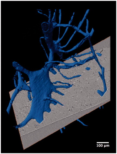 Figure 4. Synchrotron radiation-based micro-CT 3D render of adjacent interconnecting osteonal canal networks (blue). A 2D slice is included to demonstrate their contributions to a complex osteon band. Scale = 100 μm. Credit: JM Andronowski. Reprint permission granted by the publisher. (For interpretation of the references to colour in this figure legend, the reader is referred to the web version of the article).