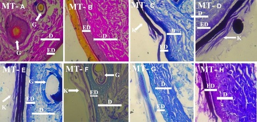 Figure 2 Photomicrograph of the skin of the experimental animals in Groups A–H demonstrating the skin using the Masson’s trichrome technique (MT A-H; X400). The connective tissue was relatively generally preserved in the skin layers (MT A-H).