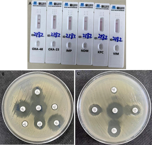 Figure 3 Rapid enzyme type detection (A) and combination susceptibility test in vitro (B and C).