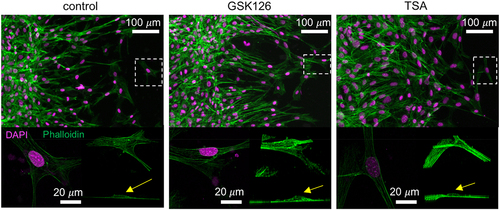 Figure 4. Characteristics of the stress fiber formation in migrating cells upon chromatin modification. The staining of NIH 3T3 cells reveal that F-actin or stress fiber formation is not visibly disrupted by the chromatin modifying drugs. Cells are migrating from left to right. Bottom panel shows a higher magnification images of a selected cell in the field of view (in white dotted box) along with its 3D isometric view and side view. The nuclear dome (yellow arrow) and the actin stress fiber formation around the nucleus is visible.