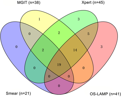 Figure 2 Venn diagram showing the distribution of 101 patients for detection of MTB by using smear microscopy, MGIT, Xpert, and oral swab testing. Among 101 patients included, 41 were positive for MTB by oral swab testing, whereas, 45, 38, and 21 samples were positive by Xpert, MGIT and smear microscopy, respectively.
