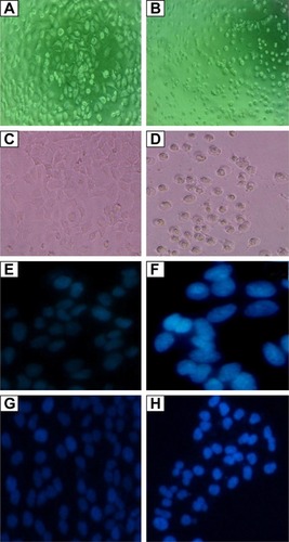 Figure 6 Images showing cytotoxic effect of AgPgNps on HeLa and A549 cell lines at 20× magnification.Notes: HeLa cells: (A) control and (B) treated with AgPgNps. A549 cells: (C) control and (D) treated with AgPgNps. DAPI staining of HeLa cells: (E) control and (F) treated with AgPgNps. DAPI staining of A549 cells: (G) control and (H) treated with AgPgNps. Primary osteoblasts were used as control and were unaffected up to a substantial concentration of AgPgNps (picture not shown).Abbreviations: AgPgNps, pentagonal silver nanoparticles; DAPI, 4′,6-diamidino-2-phenylindole.