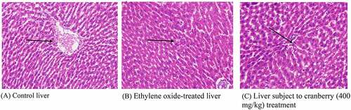 Figure 4. Histopathological examination of the livers of rats before and after treatment with cranberry (scale bar 35 microns with 40x magnification). Following exposure to EtO, the normal structural organization of the hepatic lobules indicated damaged cells with a loss of characteristic cord-like arrangements