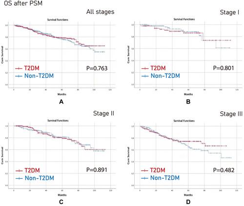 Figure 4 OS after PSM. (A) All stages; (B) Stage I; (C) Stage II; (D) Stage III.