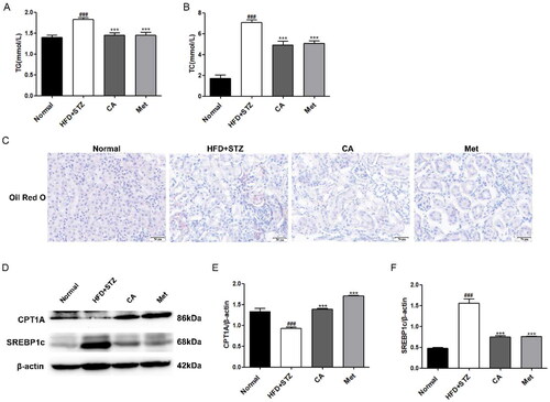 Figure 5. Effects of CA on serum lipids, renal lipid accumulation and lipid metabolism in HFD/STZ-induced DKD mice. (A-B) Serum TG, TC; n = 6 (C) Oil red O staining of frozen sections of kidney tissue; (D-F) Western blotting and quantitative analysis of CPT1A and SREBP1c proteins in renal tissue(magnification × 400). Data are presented as means ± SEM; ###p < 0.001 vs. Normal group; ***p < 0.001 vs. HFD + STZ group, n = 6.