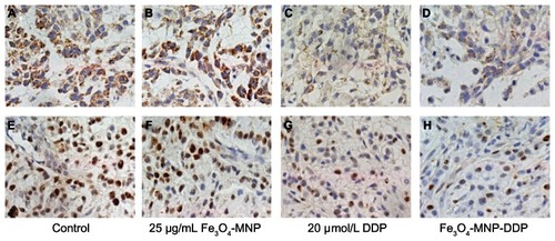 Figure 9 Immunocytochemistry staining for lung resistance-related protein. (A–D) and Ki-67(E–H) in mice tumor model tissue (×200).Abbreviations: Fe3O4-MNP, magnetic Fe3O4 nanoparticles; DDP, cisplatin.