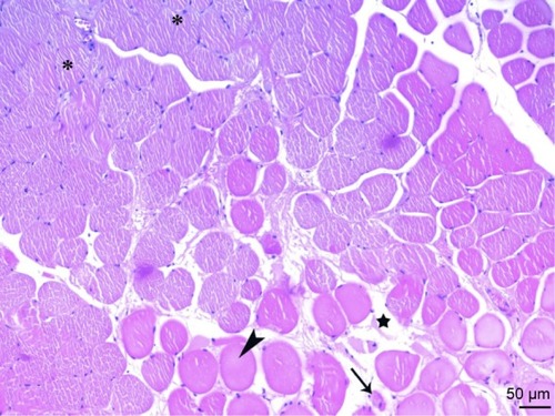 Figure 11 Cross-sections of the fibers in the micrograph of the ischemia reperfusion + picroside II group, show a rounded shape of the cross-sections (arrowhead) and increase in distance between muscle fibers (star), atrophic muscle fibers (arrow) are observed. In some areas, muscle fiber sections (asterisk) showing a normal, multifaceted cross-sectional surface are observed. H&E ×200.
