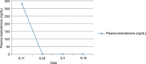 Figure 4 The patient was referred for a left adrenal laparoscopic excision on August 22, 2016.Notes: After the surgery, her plasma testosterone level was back to normal.