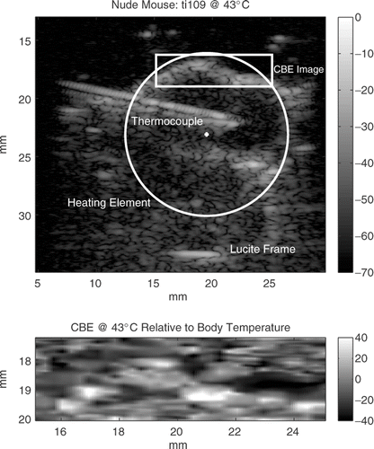 Figure 7. Upper panel: Terason 3000 image at 7.5 MHz of an HT29 tumor in the leg of a nude mouse heated to 43°C at the thermocouple. The circle shows the position and size of the heating transducer. Lower panel: CBE at 43°C compared to body temperature for the inset region above the thermocouple probe in the conventional image. Tissue volume for the CBE image is 0.075 cm3. Vertical bars show the image intensities in dB.