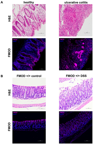 Figure 1 FMOD is upregulated and re-localized in colitis. (A) Colon biopsy samples from healthy individuals and patients diagnosed with UC were stained with H&E or subjected to immunostaining for FMOD. Representative images were captured at x20 magnification. (B) FMOD+/+ mice were given 3% DSS in drinking water for 7 days. Representative samples were H&E stained or immunostained for FMOD. Images were obtained at x20 magnification.