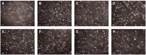 Figure 1. Cells were grown in flask until approximately 50% confluent and photographed using a phase contrast microscope. (A) LU-TC-1, (B) LU-TC-2, (C) LU-TC-7, (D) LU-TC-8, (E) LU-TC-10, (F) LU-TC-12, (G) LU-TC-14, and (H) LU-TC-15. Bars indicate 100 µm.