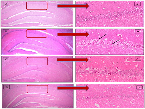 Figure 3. Descriptive photomicrographs (×400) of hematoxylin and eosin (H&E) staining (upper panel) revealing the neuroprotective impact of melatonin (MEL) on hippocampal CA1 region. (A,a) Sham, (B,b) Ischemia/reperfusion (I/R), (C,c) MEL solution-treated group, and (D,d) lipid nanocapsules LNC-treated group. The areas in the low field pictures (A,B,C,D) which are magnified as high power field pictures are denoted by red rectangles. Black arrows point at injured neurons.
