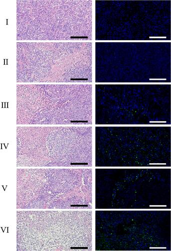 Figure 7 Histopathological confirmation of efficient therapeutic efficacy of PTX-PLGA@[143B-RAW] NPs against 143B tumor. H&E and TUNEL-stained tumors of mice after treatment. (I) PBS; (II) Free PTX; (III) PLGA-PTX NPs; (IV) PTX-PLGA@RAW NPs; (V) PTX-PLGA@143B NPs; (VI) PTX-PLGA@[143B-RAW] NPs. Scale bar = 200 μm.