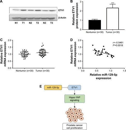 Figure 8 Expression of miR-129-5p was inversely associated with ETV1 mRNA levels in prostate cancer tissues.Notes: (A) Representative Western blot of ETV1 expression in three pairs of prostate tumor tissues and matched normal tissues. (B) Quantification of ETV1 protein levels in prostate tumor tissues and matched normal tissues in (A). (C) Reverse transcription-quantitative PCR showed that ETV1 mRNA levels were significantly elevated in 30 prostate tumor tissues compared with adjacent normal prostate tissues. (D) Analysis of miR-129-5p expression and ETV mRNA levels showed a negative correlation between them. (E) Diagram of an miR-129-5p/ETV1/Hippo-YAP axis in prostate cancer cells. *P<0.05, ***P<0.001.