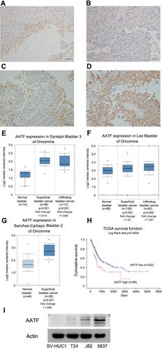 Figure 1 Expression of AATF in bladder cancers. (A) Weak AATF staining in normal bladder uroepithelial tissue. (B) Negative AATF staining in a bladder cancer. (C) Moderate AATF staining in a case of bladder cancer. (D) Strong cytoplasmic and nuclear AATF staining in a case of bladder cancer. (E) Analysis of Dyrskjot bladder 3 Oncomine dataset suggested that AATF mRNA was increased in bladder cancers compared with normal bladder tissues. (F) Analysis of Lee bladder dataset suggested that AATF mRNA was higher in bladder cancer tissues compared with normal bladder tissues. (G) Analysis of Sanchez-Carbayo bladder 2 suggested that AATF mRNA was higher in superficial bladder cancers compared with normal bladder. (H) Analysis of TCGA data using Kaplan–Meier curves showed that high AATF levels was associated with poor survival (p = 0.0024, Log rank test) in bladder cancer patients. (I) Western blotting showed that AATF protein was low in normal uroepithelial cell line SV-HUC-1 and higher in BC cell lines J82 and 5637. (Magnification: 400×; bars indicates 50µm).