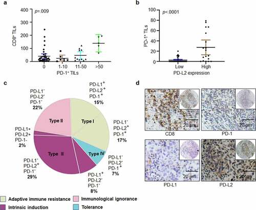 Figure 2. Heterogeneity of PD-1, PD-L1, and PD-L2 expression in HNSCC. (a) Correlation between cell density of PD-1-positive lymphocytes and TILs identified by CD8+ staining in HNSCC specimens. (b) Relation among cell density of PD-1+ TILs based on PD-L2 expression level. (c) Based on differential expression of PD-1, PD-L1 and PD-L2, the tumor microenvironment can be divided into four different types. (d) Representative immunohistochemical patterns of adaptive immune resistance with PD-1+, PD-L2+, CD8+, and PD-L1− cells