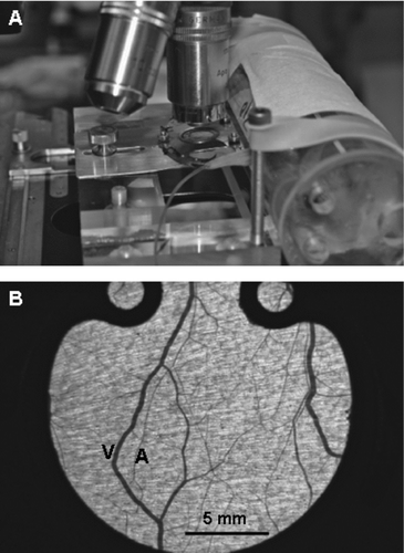 Figure 1 (A) An un-anesthetized hamster rests comfortably in a custom plastic holder and the whole assembly is fitted under an intravital microscope. (B) 4X magnification of microvascular network in window. Arterioles (A), venules (V) and capillaries (C) are labeled accordingly. Note parallel arrangement of arteriole venule pair.