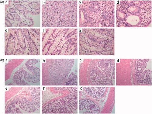 Figure 3. Microscopic damage changes (A, H&E stain, ×400; and B, H&E stain, ×100) of the distal colon in seven groups (n = 10): (a) normal group, (b) model group, (c) Pae-GC 1 group, (d) Pae-SME-CSC 1 group, (e) Pae-GC 2 group, (f) Pae-SME-CSC 2 group, and (g) SASP group.