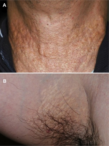 Figure 2 Appearance of the skin.