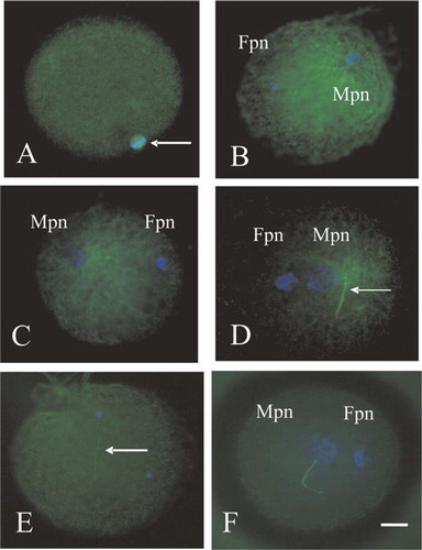 Figure 1 Microtubule (green) and chromatin (blue) configurations in the bovine eggs (A) and in the bovine eggs after heterologus ICSI with human sperm (B–F). Fpn, Female pronucleus; Mpn, Male pronucleus. Bar=10 μm. A: Unfertilized bovine egg that is arrested in Metaphase II displays a second meiotic spindle (arrow). B, C: The male and female pronuclei have decondensed. Microtubules are formed radially from sperm centrosome and are not present around the female pronucleus. D: The short sperm aster is observed, separated from male nucleus (arrow: sperm tail). E: The injected sperm nucleus remains intact and sperm tail (arrow) is observed away from sperm head. The female pronucleus, microtubule organization and the sperm aster are not visible. F: Male and female pronuclei with absent sperm asters were observed.