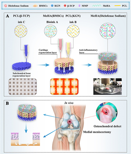 Figure 2 Schematic illustration of bioprinting scaffold fabrication and scaffold treatment for osteochondral defects in OA. (A) The fabrication of 3D-bioprinted MSC-laden biomimetic multiphasic scaffolds. (B) The designed scaffold was implanted into a severe joint injury rat model with osteochondral defects for evaluation. Reprinted from Biomaterials, 279, Liu Y, Peng L, Li L, et al 3D-bioprinted BMSC-laden biomimetic multiphasic scaffolds for efficient repair of osteochondral defects in an osteoarthritic rat model. 121216. Copyright 2021, with permission from Elsevier.Citation25