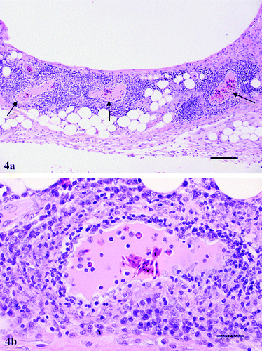 Figure 4. 4a: Keel bursa from a 47-day-old broiler chicken infected with M. synoviae showing severe perivascular cuffing (arrows) by mononuclear inflammatory cells. Haematoxylin and eosin, bar=200 μm. 4b:Higher magnification of one field from 4a showing in more detail prominent endothelial cells and infiltration by lymphocytes, a few plasma cells and macrophages in and around a blood vessel. Haematoxylin and eosin, bar=50 μm.