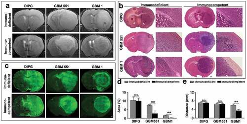 Figure 3. Identification of implanted xenografts and their morphologies with MRI and histology. Anatomical T2-weighted MR imaging (a), H & E staining (b), and Human Nuclear Antigen (HuNu) immunostaining (c) showed the morphologies of human DIPG, GBM551, and GBM1 tumors in immunodeficient and immunocompetent mice. The scale bars are 500 μm. (d) Quantification of contralateral hemisphere HuNu+ area/total contralateral hemisphere area and (e) the farthest distance of tumor cells from tumor center (n = 9 slices from three animals each group). Mean ± SD, **p < 0.01, n.s. is no significant difference, independent t-test.