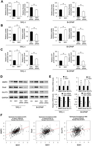 Figure 4 Six1 regulates glucose metabolism and GLUT3, Snail, MMP2 expression. (A) Relative glucose consumption rate in thyroid cancer cells transfected with Six1 plasmid and siRNA. (B) Relative lactate production rate in thyroid cancer cells transfected with Six1 plasmid and siRNA. (C) Relative ATP production level in cells with Six1 plasmid and siRNA. (D) Protein levels of MMP2, Snail and GLUT3 in thyroid cancer cells transfected with the Six1 plasmid and siRNA. (E) The mRNA levels of MMP2, Snail and GLUT3 in thyroid cancer cells transfected with Six1 plasmid and siRNA. (F) Pearson’s correlation analysis showing positive associations between Six1 and MMP2, Snail and GLUT3 mRNA in 501 cases of thyroid cancer tissues (TCGA dataset). *p<0.05.