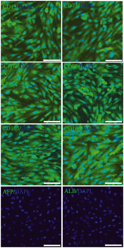 Figure 2. Special gene characteristics of human ADSCs. Immunoflourescence staining results showed that human ADSCs were positive for the CD13, CD71, CD73, CD90, CD105, and CD166, but negative for liver-associated genes, ALB and CYP3A4 (Scan bar = 50 μm).