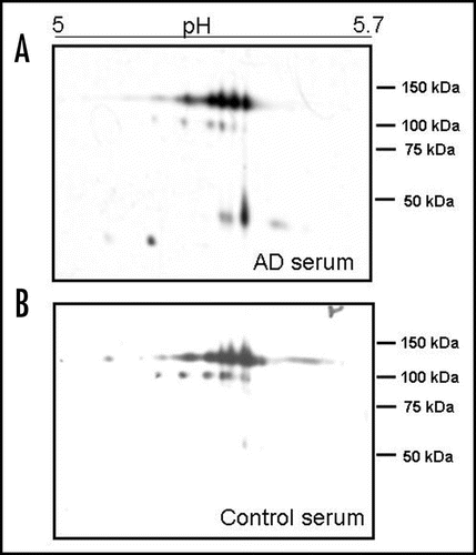 Figure 2 2D analysis of serum ceruloplasmin in AD (A) and controls (B). The pH 5–5.7 range is shown. Note the protein pattern similarity at about 135 and 115 kDa. Low-molecular-weight (<50 kDa) positive spots are present only in AD serum (A). 450 µl of a 1.5 mg/mL protein solution were loaded per gel. Ceruloplasmin content in both pools was brought 28 mg/dL and each serum sample contributed equally to the ceruloplasmin content.