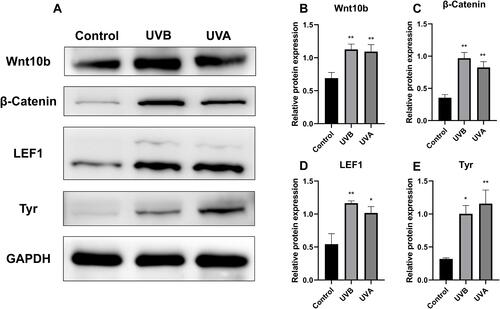 Figure 5 Relative protein expression by Western blot. (A and B) Compared with the control group, relative protein expression of Wnt10b was increased in both the UVB and the UVA groups. (A and C) The expression of β-catenin was also higher in both the UVB and the UVA groups as compared to the control group. (A and D) LEF1 expression was higher in the UVB and UVA groups than in the control group. (A and E) Western blot showed that UV irradiation up-regulated the expression of Tyr. (*P<0.05, **P<0.01).